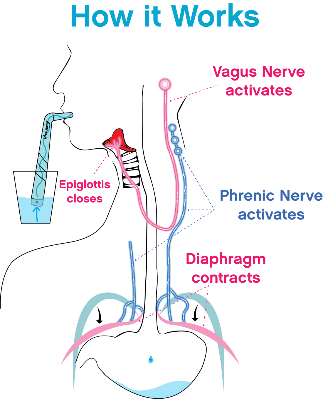 Reusable Anti Hiccup Artifact L Shaped Straws